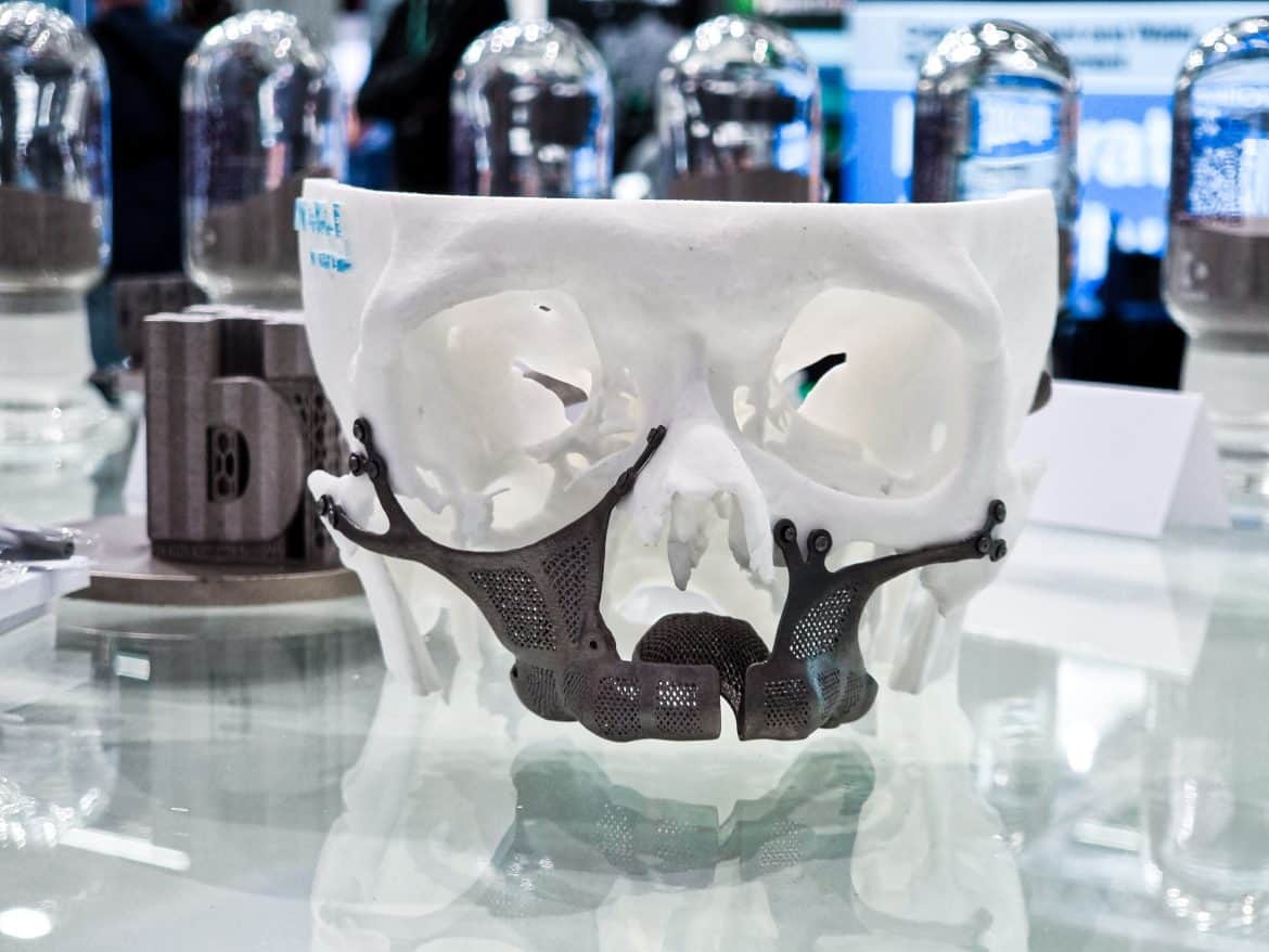 A titanium alloy impant and mould