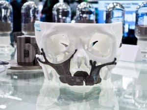 A titanium alloy impant and mould